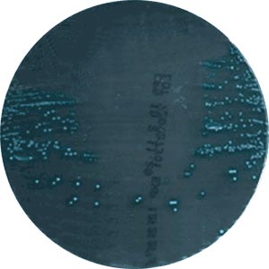 effet antibactérien des urines