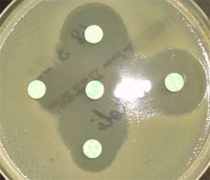 Test de synergie (bouchon de champagne)