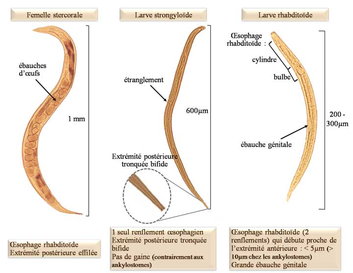 Strongyloides stercoralis (Anguillule)