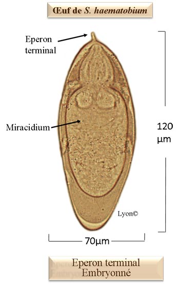 Schistosoma haematobium