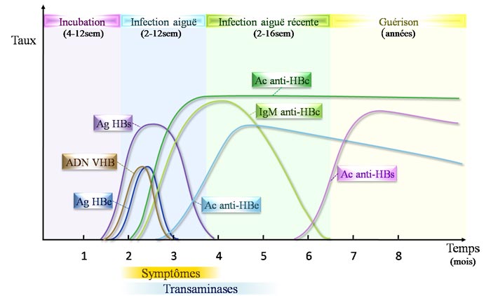 Sérologie d'une hépatite B aiguë